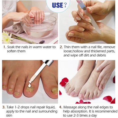 Nail Fungus Treatments Serum Anti-Infection 7DAYS Repair Foot Onychomycosis Paronychia Toe Care Nails Fungal Removal Gel  uñas