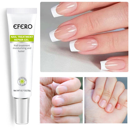 1/2/3/5pcs Nail Repair Essence Nourishing Brighten Foot Finger Care Nail Serum Nail Treatment Cream Women Men Nails Products