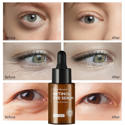 Retinol Face Cream+Facial Serum+Eye Serum Set Anti-Aging Remove Wrinkle Eye Bag Whitening Moisturizing Skin Lightening Cream