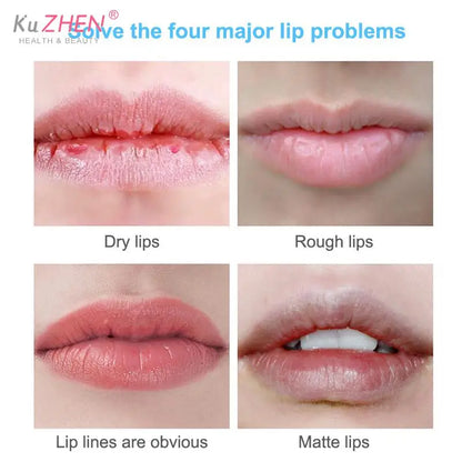 5g Lip Care Of Lip Pink Fresh Lightening Bleaching Cream Treatment Remove Dark Smoke Lips Lip Oil Nourish Moisturize Chapstick