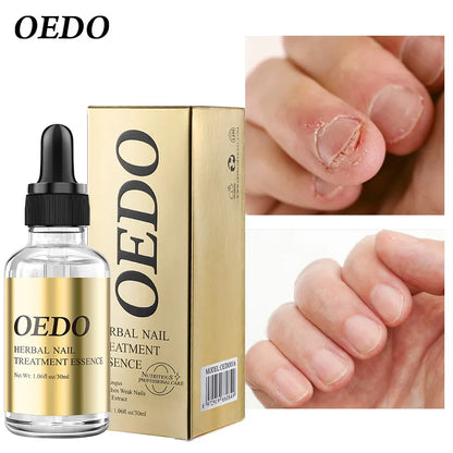OEDO Herbal Nourishing Nail Care liquid Whitening nails Remove infection Improve rough nails Restore nail shine Nail Polish