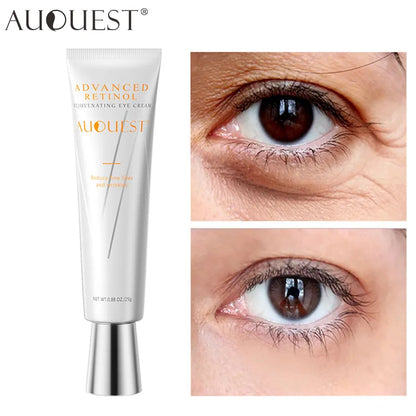 AUQUEST Anti Dark Circles Eye Cream Retinol Remove Bags Anti-Puffiness Moisturizing Collagen Fine Lines Skin Care Beauty Health