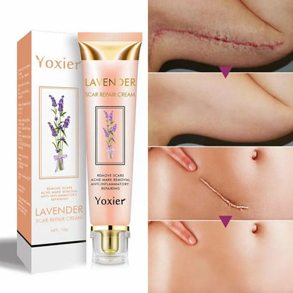 Yoxier Lavender Scar Repair Cream Acne Scar Removal Whitening Smooth Marks Skin Pigmentation Corrector Scar Removal Gel